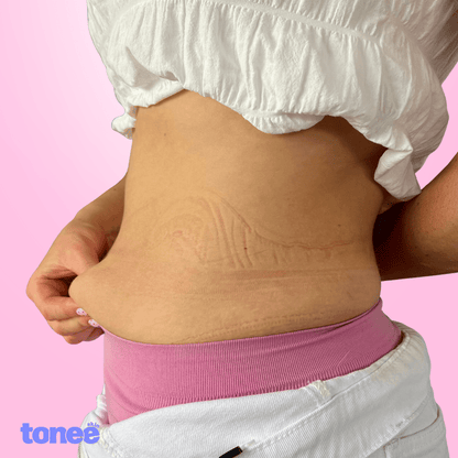 Cinta reafirmante abdominal