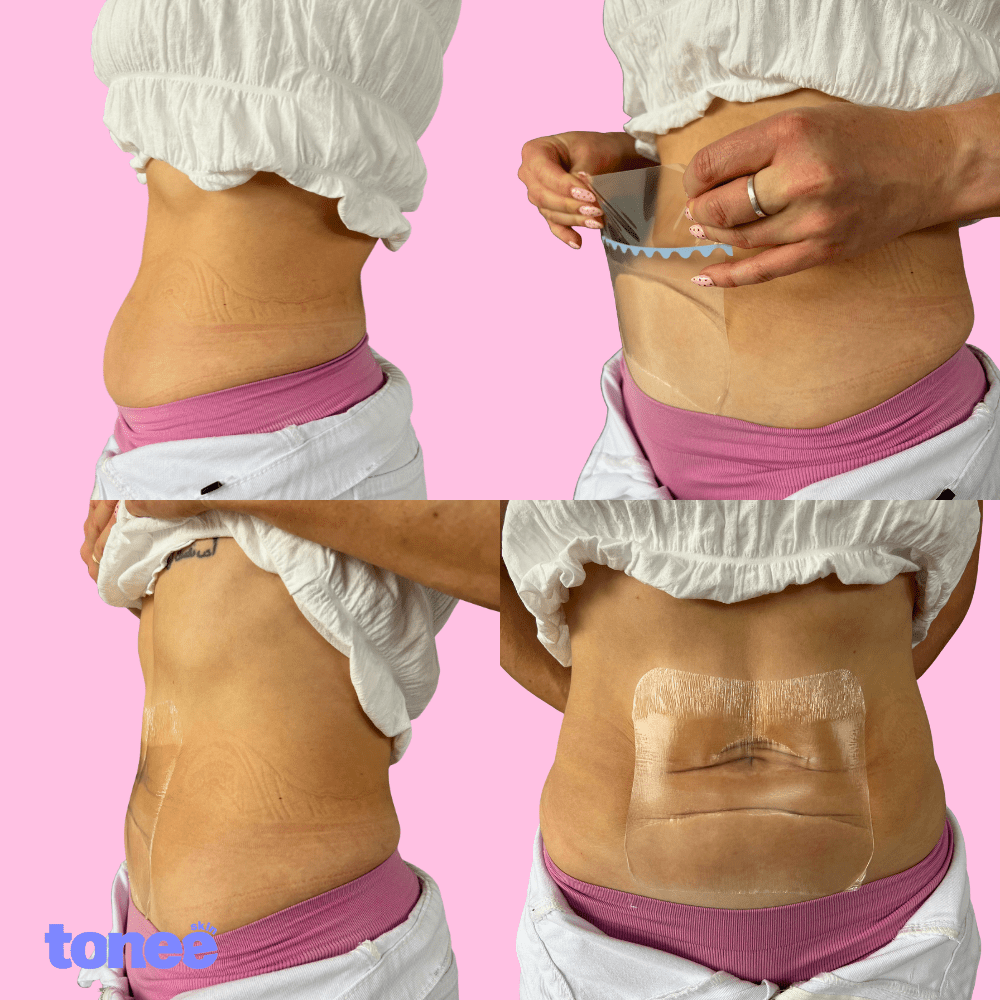 Cinta reafirmante abdominal