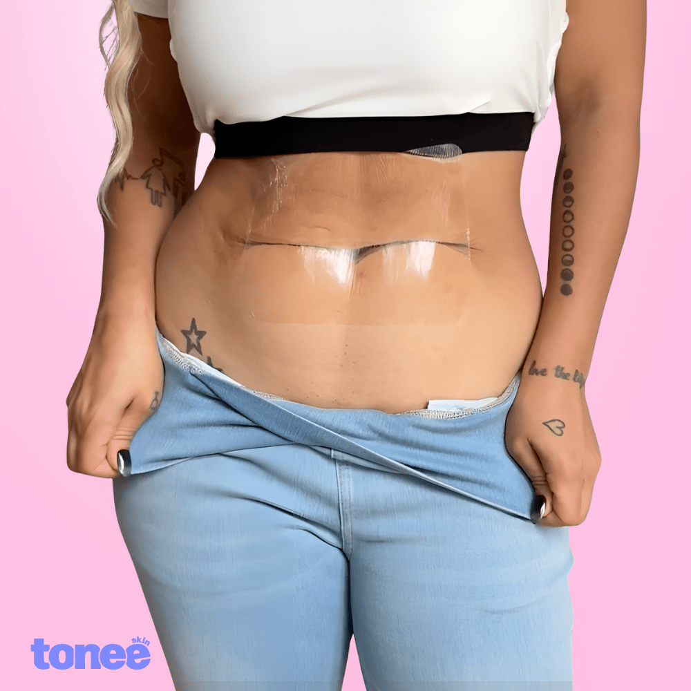 Cinta reafirmante abdominal