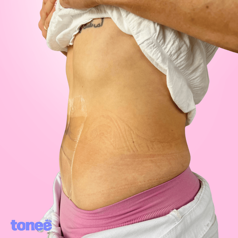 Cinta reafirmante abdominal